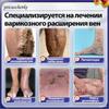 Chinese Varicose Vein Ointment for Legs, 50g