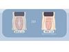 Plus Size Compression Bodysuit with Hip Lift, Abdomen Control, Row Hook, and Crotch Zipper