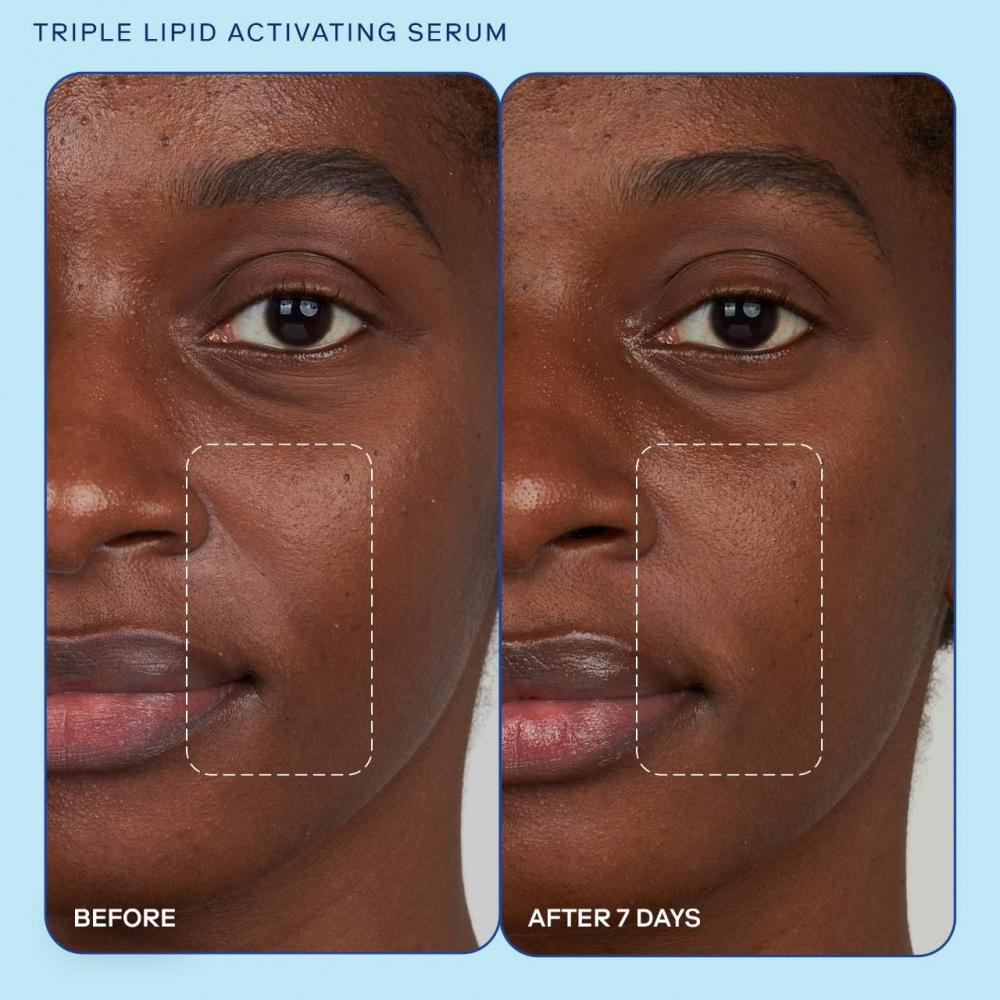 Skinfix Barrier+ Triple Lipid Activating Serum With Plumping Peptides And Niacinamide 1 Oz   30 Ml
