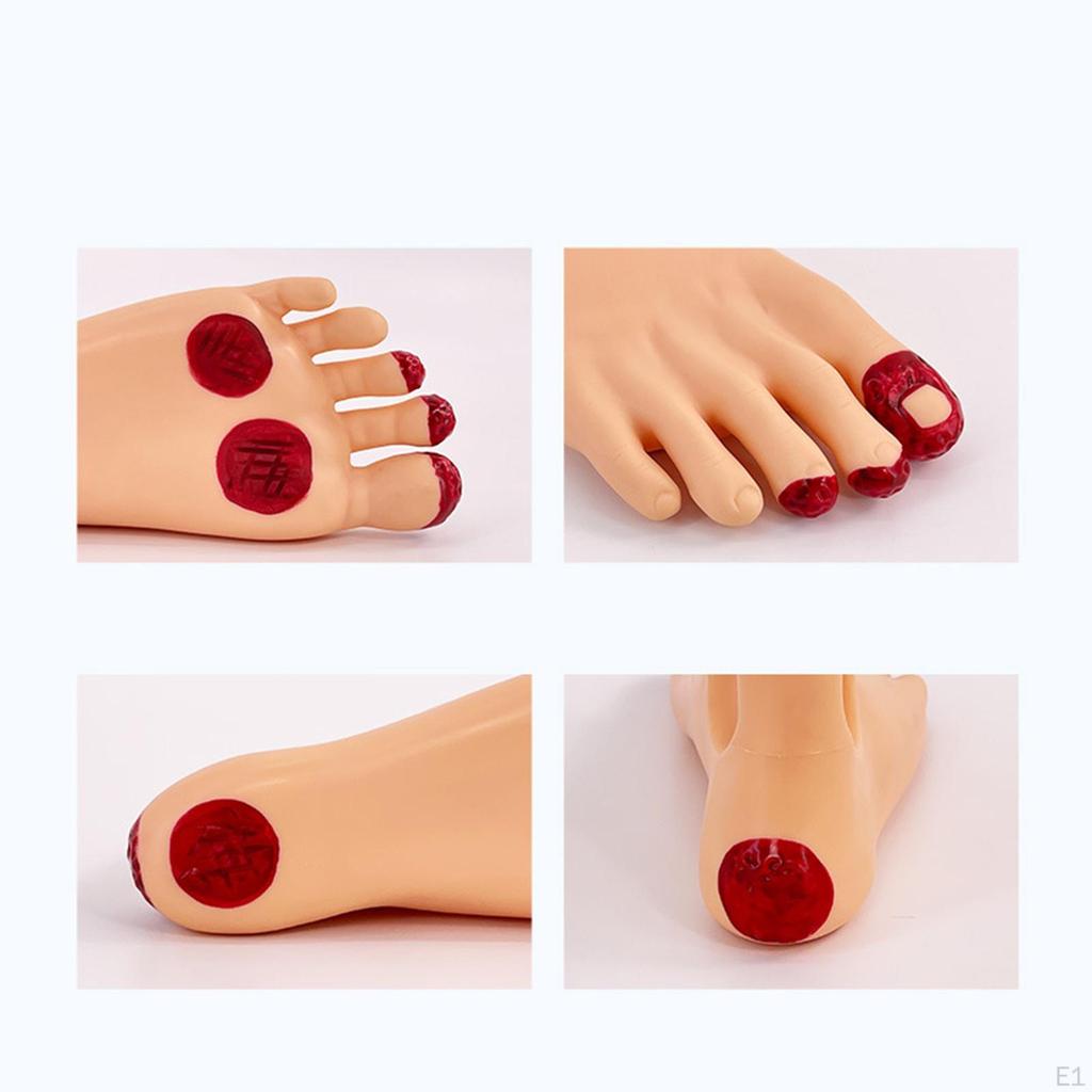 Diabetes Foot Model Simulation Realistic Supplies Training Nursing
