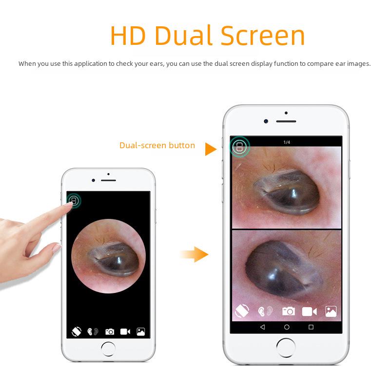 Home Edition Smart Ohrreinigungs-Endoskop mit WiFi Inspektionsspiegel