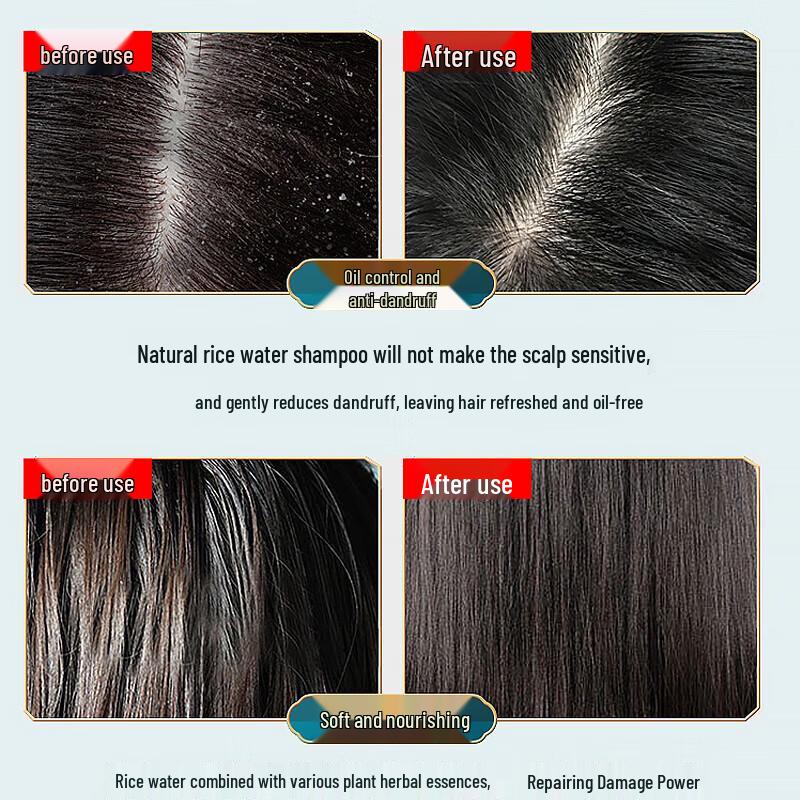 L'Oreal Hyaluronic Acid Hydrating Anti-Dandruff Shampoo, Refreshing (3x200ml)