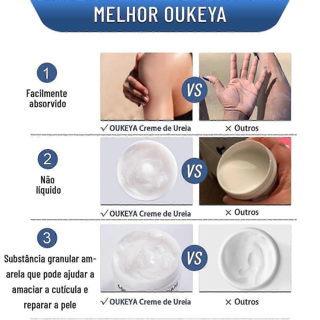 40% Harnstoffcreme mit Allantoin und Sheabutter, geeignet für trockene, rissige Haut. Eine intensiv feuchtigkeitsspendende Handcreme, die rissiger Haut entgegenwirkt
