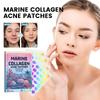 Patches For All Skin Types, SpotStickers For Face And Skin To Get Ridof Pimples And Pimples,72pcs