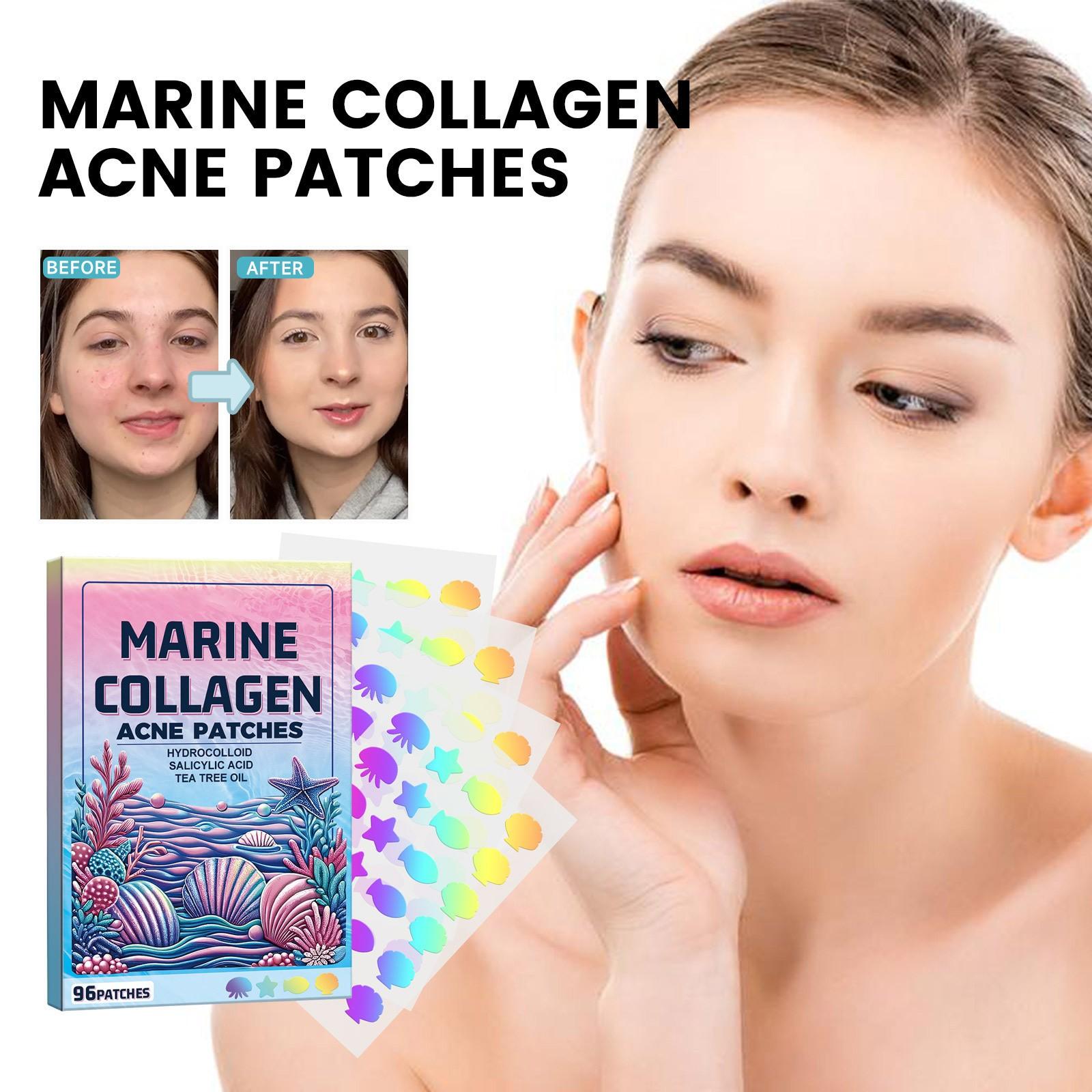 Лечебные пластыри от прыщей для всех типов кожи, точечные наклейки для лица и кожи, чтобы избавиться от прыщей и прыщей, 72 шт. One Size