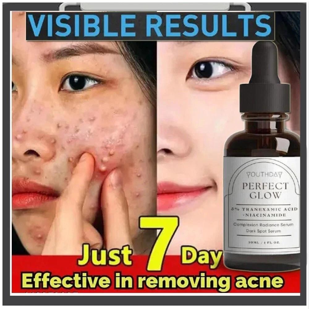 Face Serum with Tranexamic Acid and Niacinamide – Brightening, Hydrating & Firming Care for Even Skin Tone (30ml) Skin Care Serum Restoration