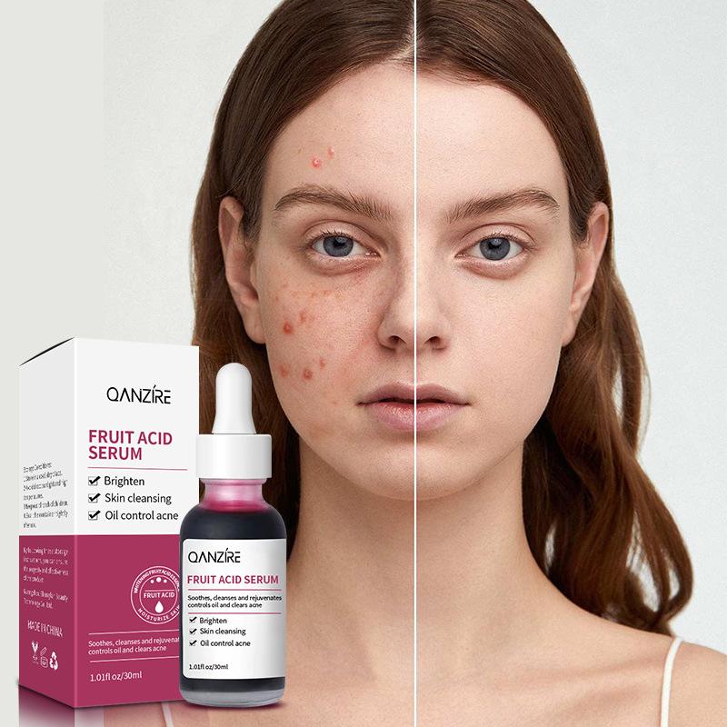 Fruit Acid Essence Hydrating and Moisturizing Facial Essence Solution