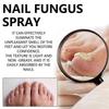 2025 Latest Model Nail Fungus Spray, Foot Moss Relief Deodorizing Odor Removal new