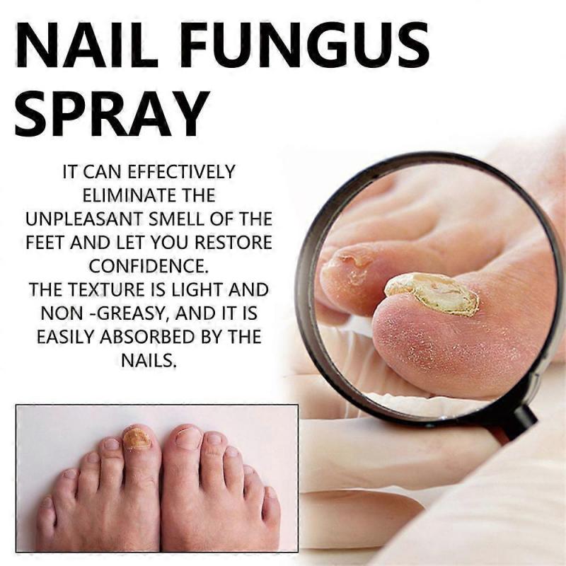 2025 Latest Model Nail Fungus Spray, Foot Moss Relief Deodorizing Odor Removal new