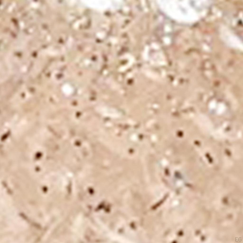 Soft Strawberry Toy Funny Cute Basket Filler Novelty Party Favors Relaxing Portable Fruit