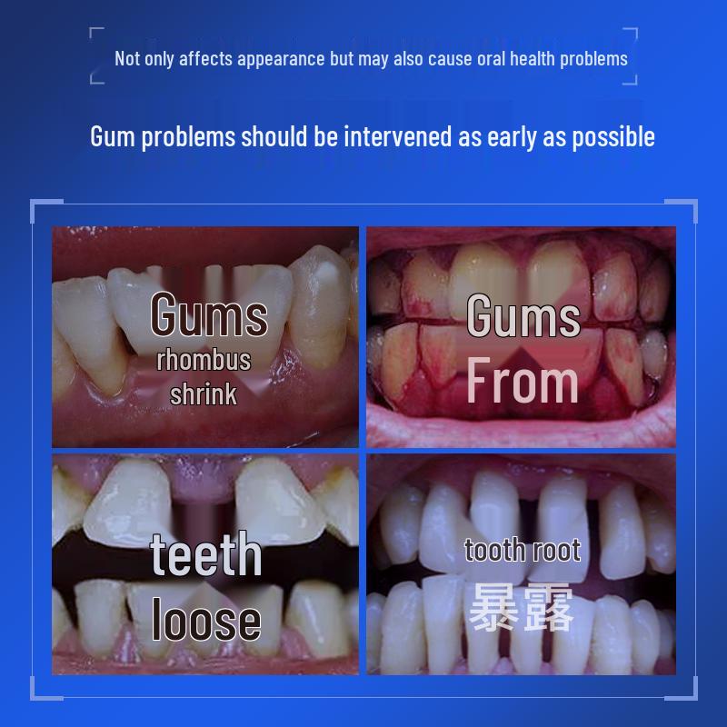 BEAI Gum Regeneration & Fresh Breath Toothpaste