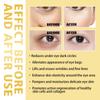 Time Eraser Oil, Time Eraser RollOn Castor Oil, Eye RollOn Oil, Eye Area Oil, Reduce Puffy Eye Bags (1 Pc),8ML