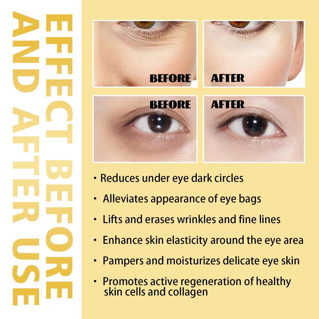 Time Eraser Oil, Time Eraser RollOn Castor Oil, Eye RollOn Oil, Eye Area Oil, Reduce Puffy Eye Bags (1 Pc),8ML