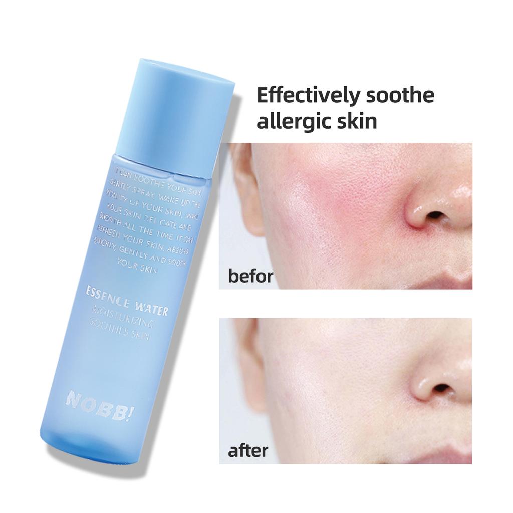 VC Brightening Essence Toner Essence Water Moisturizing Soothes Skin 155g N0301