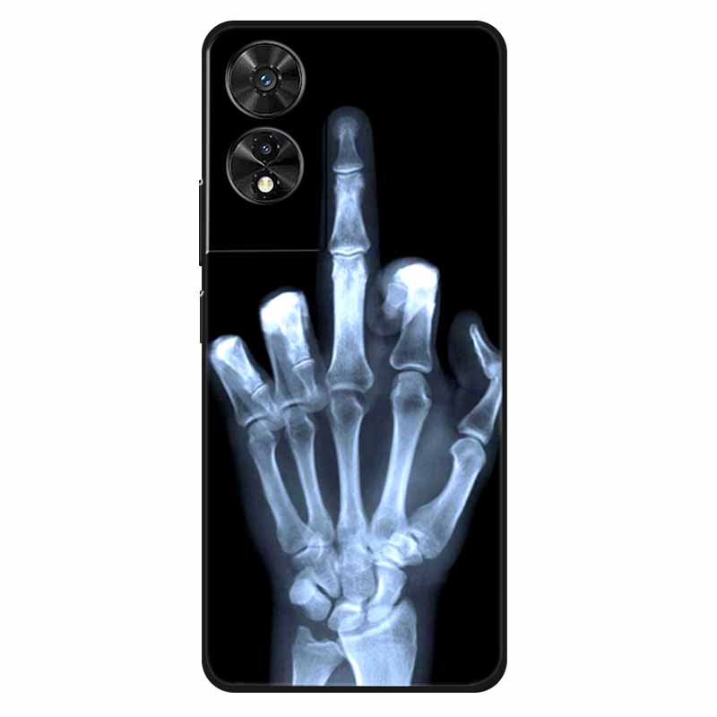 For TCL 505 Case Silicone Fashion Protective TPU Soft Funda for TCL 505 Phone Cover Animal Bumper for TCL505 Coque Shell Cute