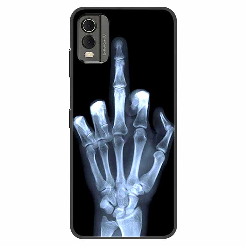 For Nokia C32 Case Shockproof Soft silicone TPU Back Cover For Nokia C32 C 32 Phone Cases NokiaC32 Cute Cartoon Fundas Shells