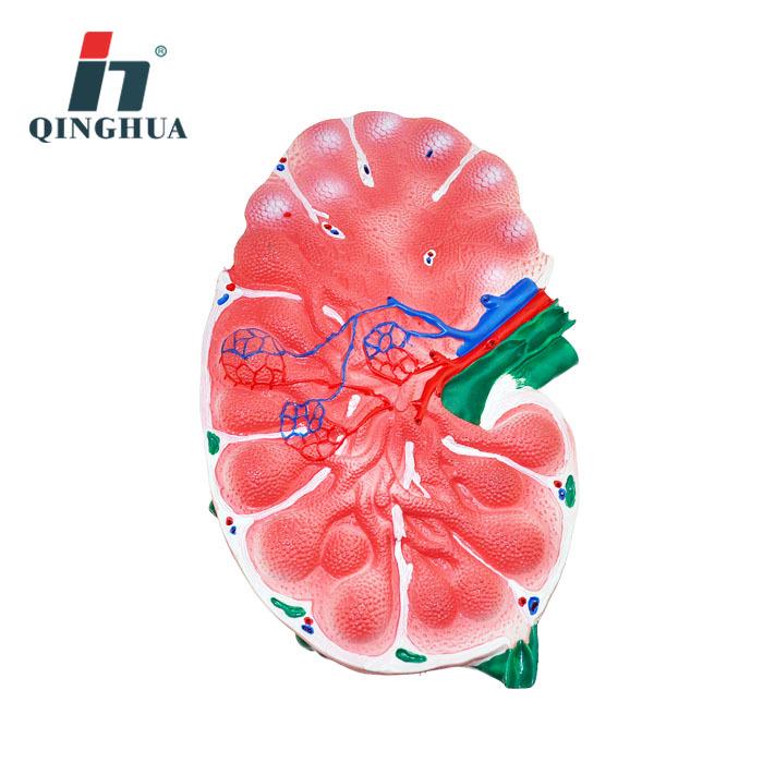 Qinghua Lymph Node Enlargement Model for Biology Teaching and Demonstration PVC