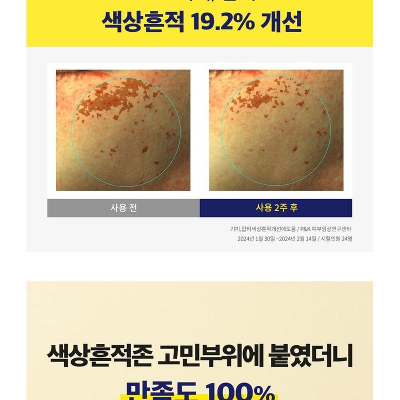 CKD Guaranteed - Vita C Teca Triple Blemish Patch