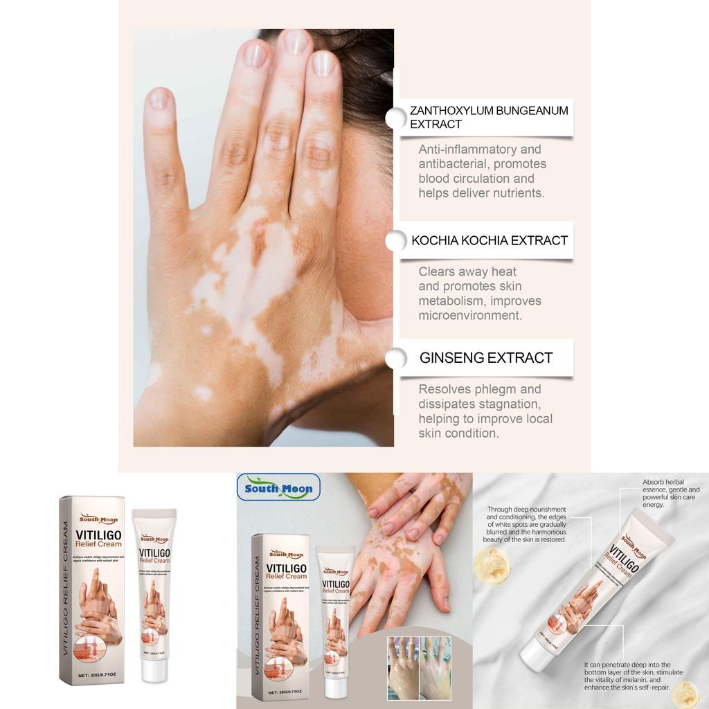 South Moon Skin Care Cream Relieves Itchy Hands And Feet Moisturizing Body Lotion