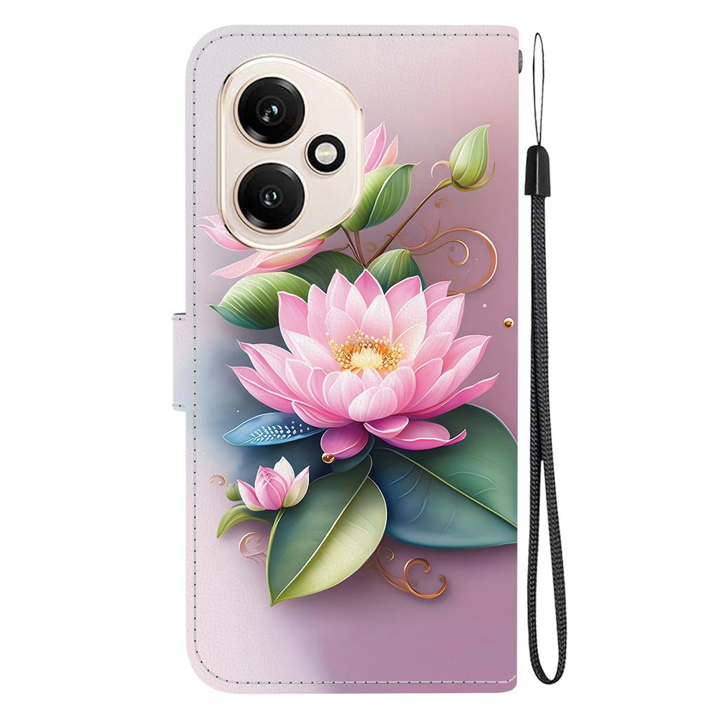 For Honor 400 5G (Global) Case Pattern Printing Leather Flip Wallet Phone Cover with Lanyard