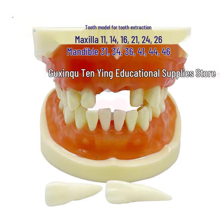 Dental Extraction Model for Oral Surgery Training & Physician Qualification Exam Practice