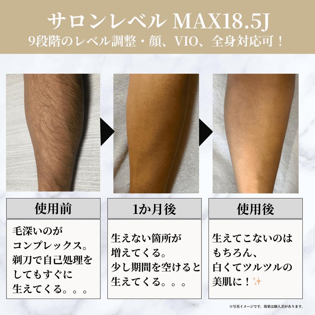 Shavio By Remozer Mole Removal Round Circle 1000 Pieces Stickers, Stickers, White, 5mm, (Single)