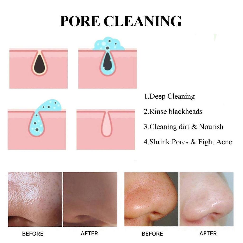 Blackhead Removal Mask Deeply Cleanses Pores, Lightening Blackheads, Oil Control And Moisturizing Smear Peel Mask