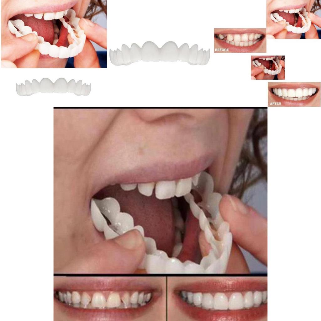 Instant Comfort Smile Cosmetic Teeth Denture Teeth Top Veneer Cosmetic