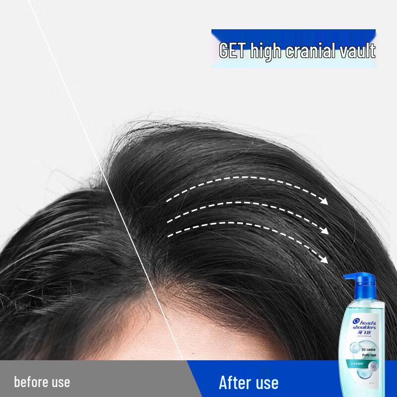 Head & Shoulders Scalp Care Shampoo