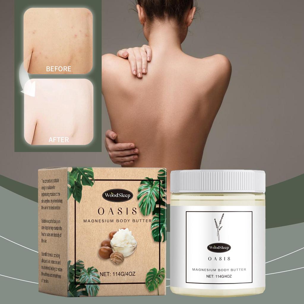 Natural Magnesium Cream Dark Spots Removal Deeply Moisturizing Repair Pores Soft Smooth Neuropathy Relief Leg Body Butter Lotion
