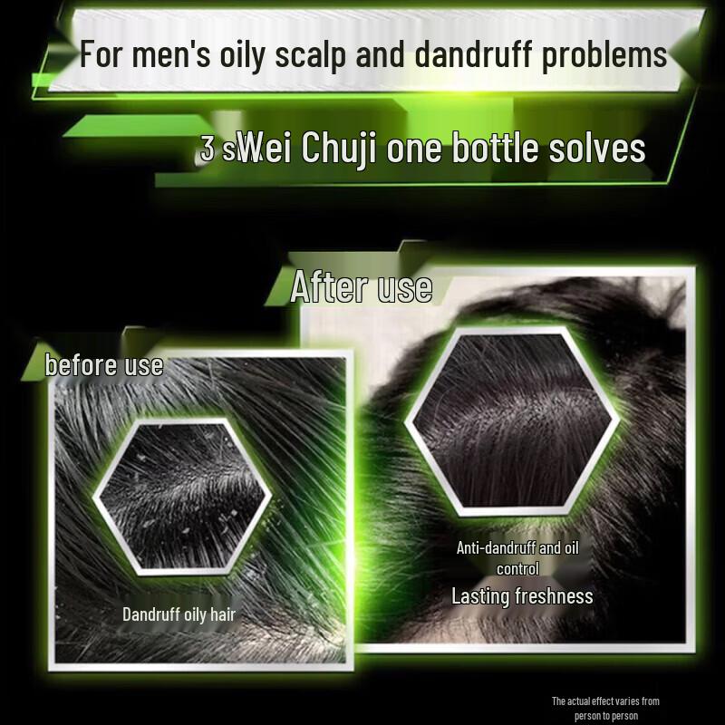 Clear Men Active Sport Mint Anti-Dandruff Shampoo