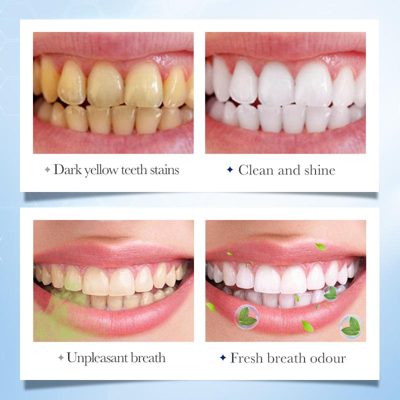 Mint Solid Toothpaste Tablets Mint Flavors Teeth Breath Mouthwash Bad Whitening Fresh Charcoal Stains