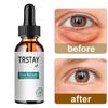 Sérum pour les yeux, Anti-rides, Anti-âge, blanchissant, éclaircissant, cernes, Essence de soin contre les poches et les poches, 5ML/15ML/30ML/50ML