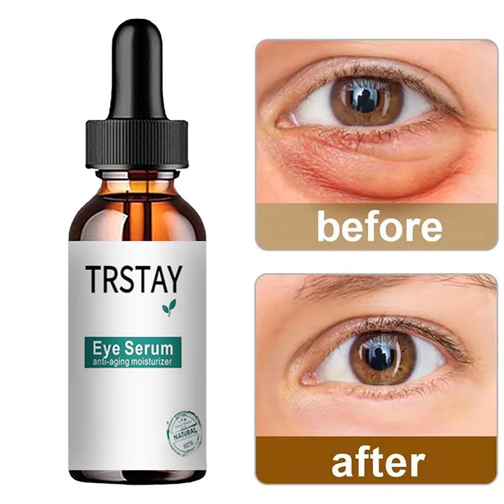 Sérum pour les yeux, Anti-rides, Anti-âge, blanchissant, éclaircissant, cernes, Essence de soin contre les poches et les poches, 5ML/15ML/30ML/50ML