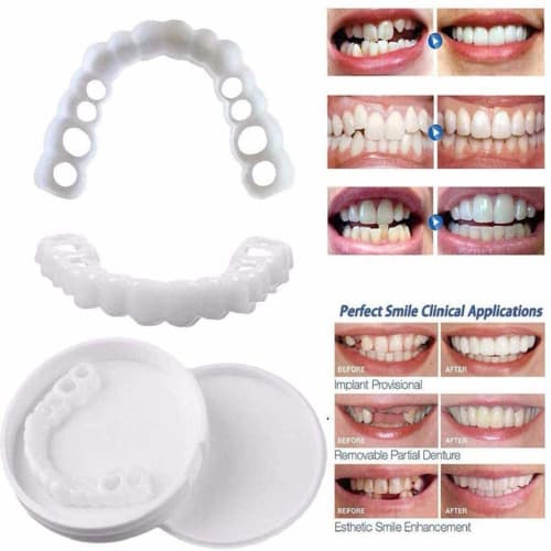 6 Sets of Dentures, Cosmetic Teeth To Cover the Top Row of a Set of White Teeth, Cosmetic Teeth, Upper and Lower Veneers
