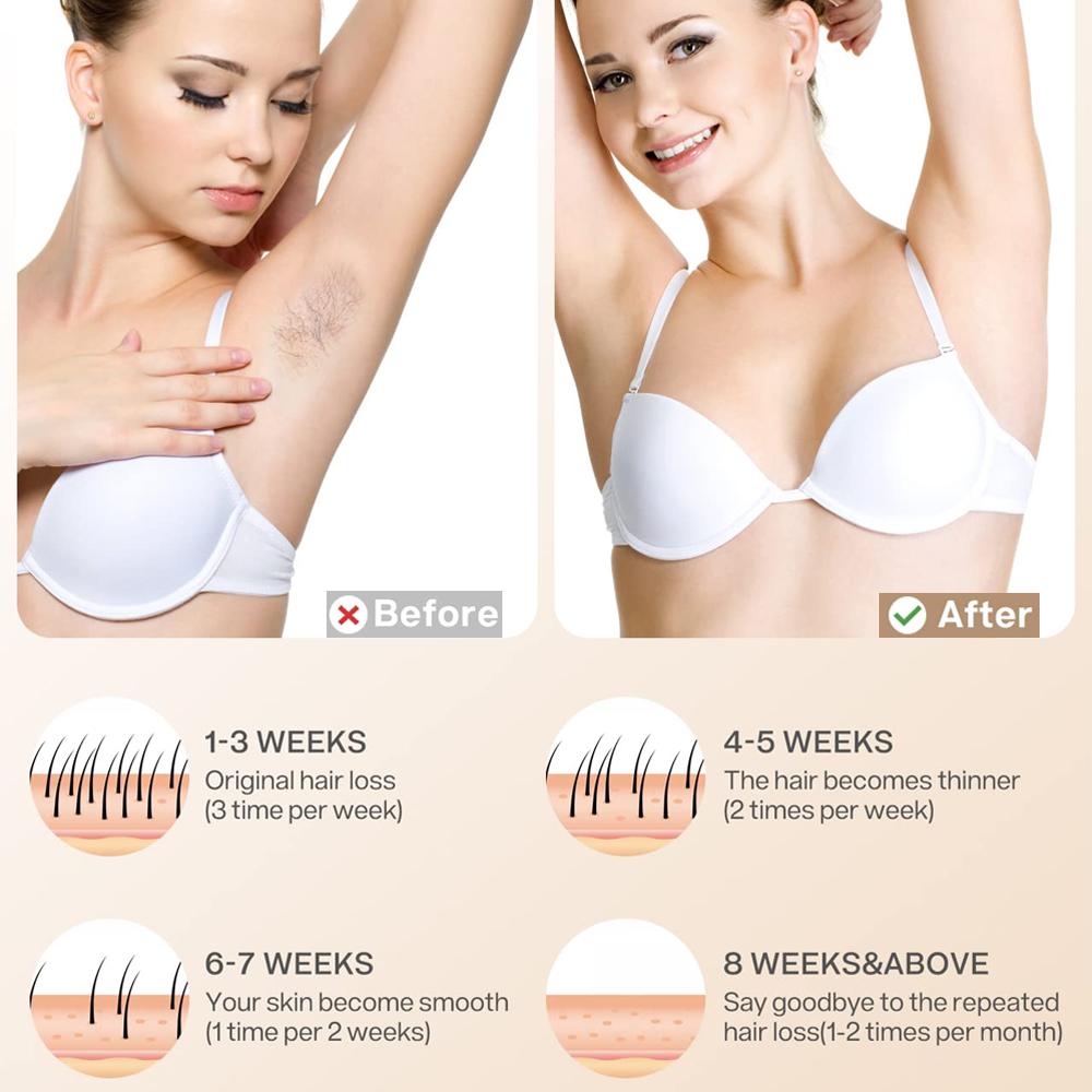 IPL Hair Removal For Ladies Permanent Laser Hair Remover Device With Ice Cooling Painless Epilator For Women Body Bikini Facial