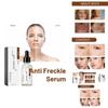 Hoygi Niacinamide Spot Brightening Serum Hydrating And Nourishing Skin Treatment For Dark Spots And Dull Complexion