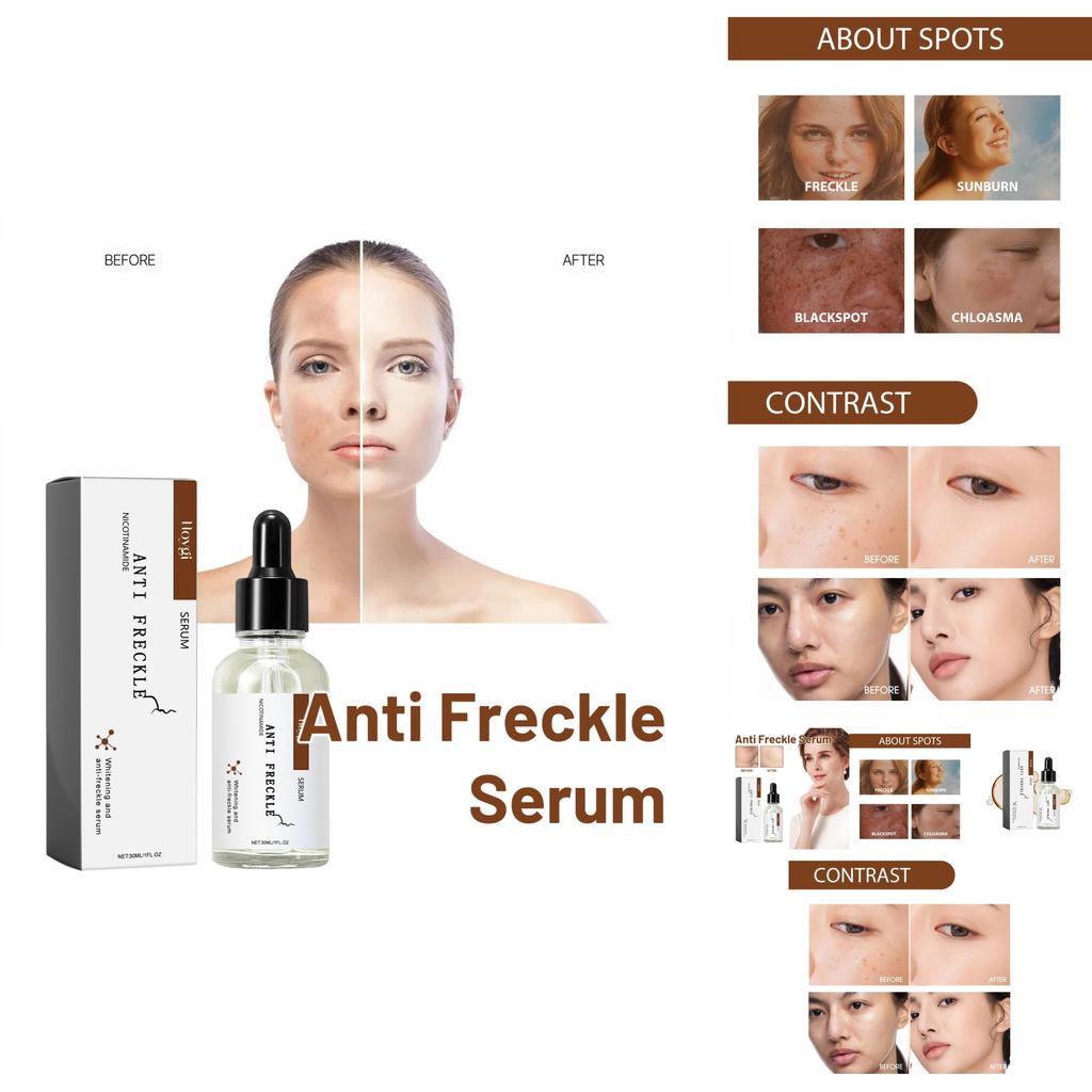 Hoygi Niacinamide Spot Brightening Serum Hydrating And Nourishing Skin Treatment For Dark Spots And Dull Complexion