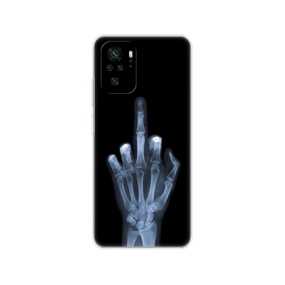 For Xiaomi Redmi Note 10 10S Case 4G 5G Silicon Soft Tpu Back On Redmi Note 10 Pro Global Phone Cover Note10 S Bumper Etui Funda