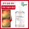 Raviel Acerola Spot   Freckle Care Ampoule 30ml