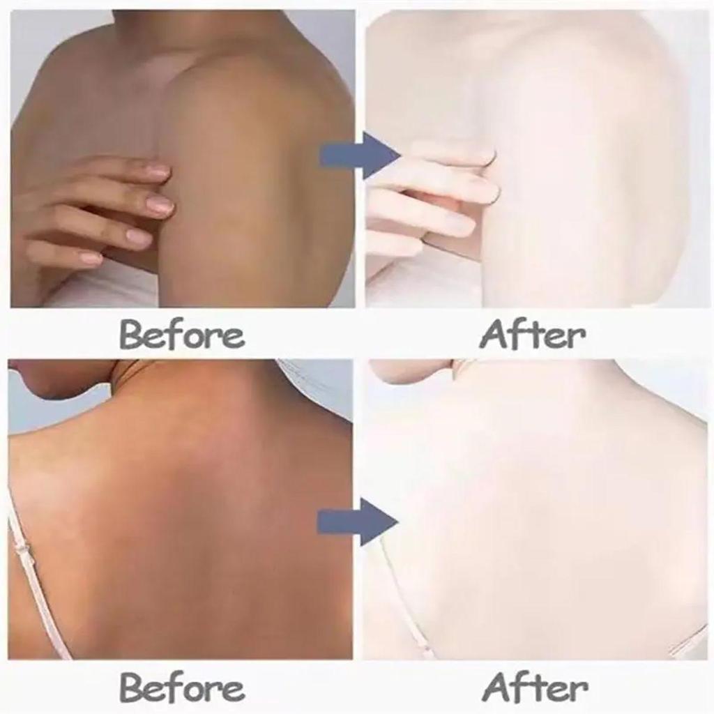 Underarm Skin Whitening Cream Reduces Melanin, Brightens the Skin, Improves Skin Plumpness, Moisturizes and Nourishes the Skin