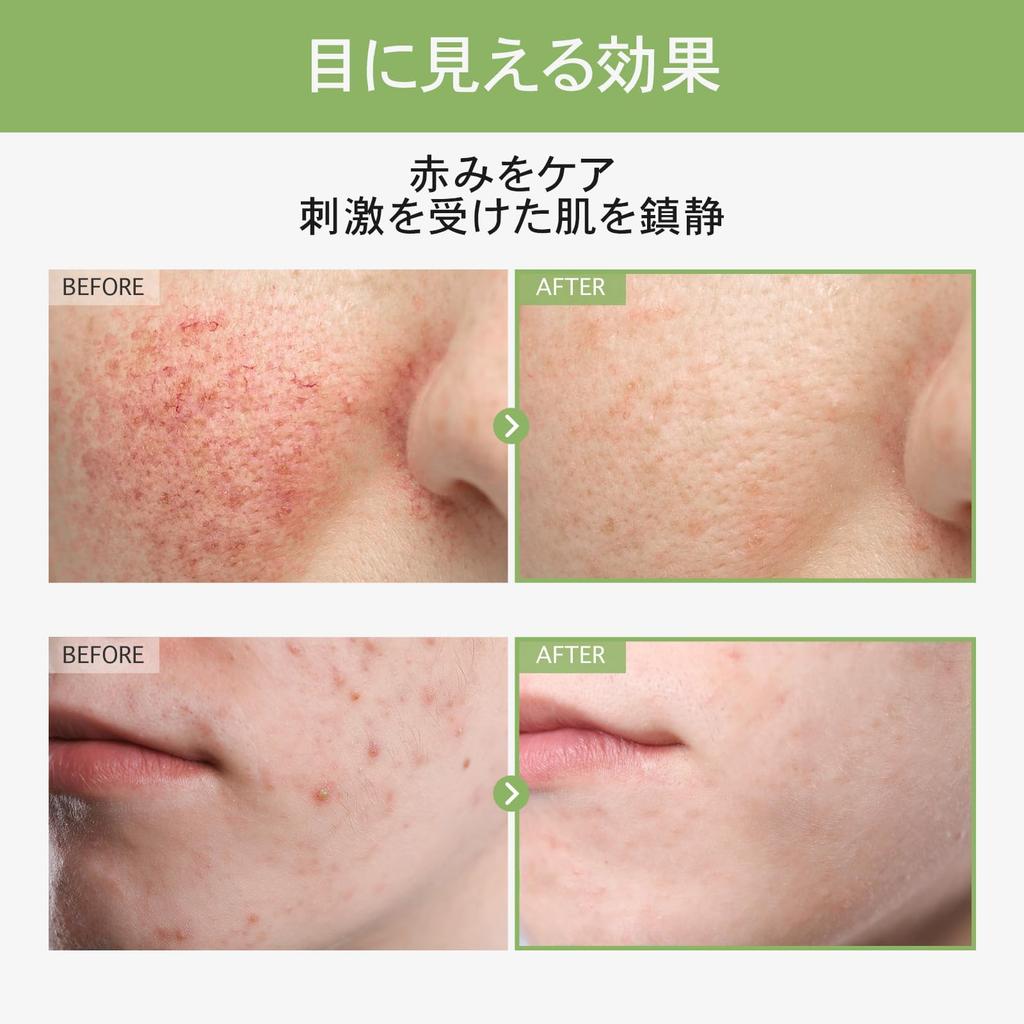 TOSOWOONG Houttuynia Cordata Toner do Twarzy Houttuynia Cordata Oczar Centella Hialuronowy Nawilżający Dla Cery Tłustej i Mieszanej Koreańska Pielęgnacja Skóry 250ml,