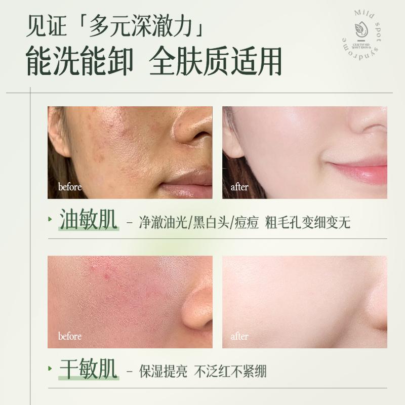 RUYI Amino Acid Moisturizing Cleansing Mousse Facial Cleanser 300ml
