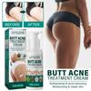 Jaysuing Butt Care Cream Nourishing Moisturizing Formula For Clear And Smooth Skin