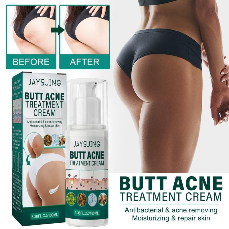 Jaysuing Butt Care Cream Nourishing Moisturizing Formula For Clear And Smooth Skin