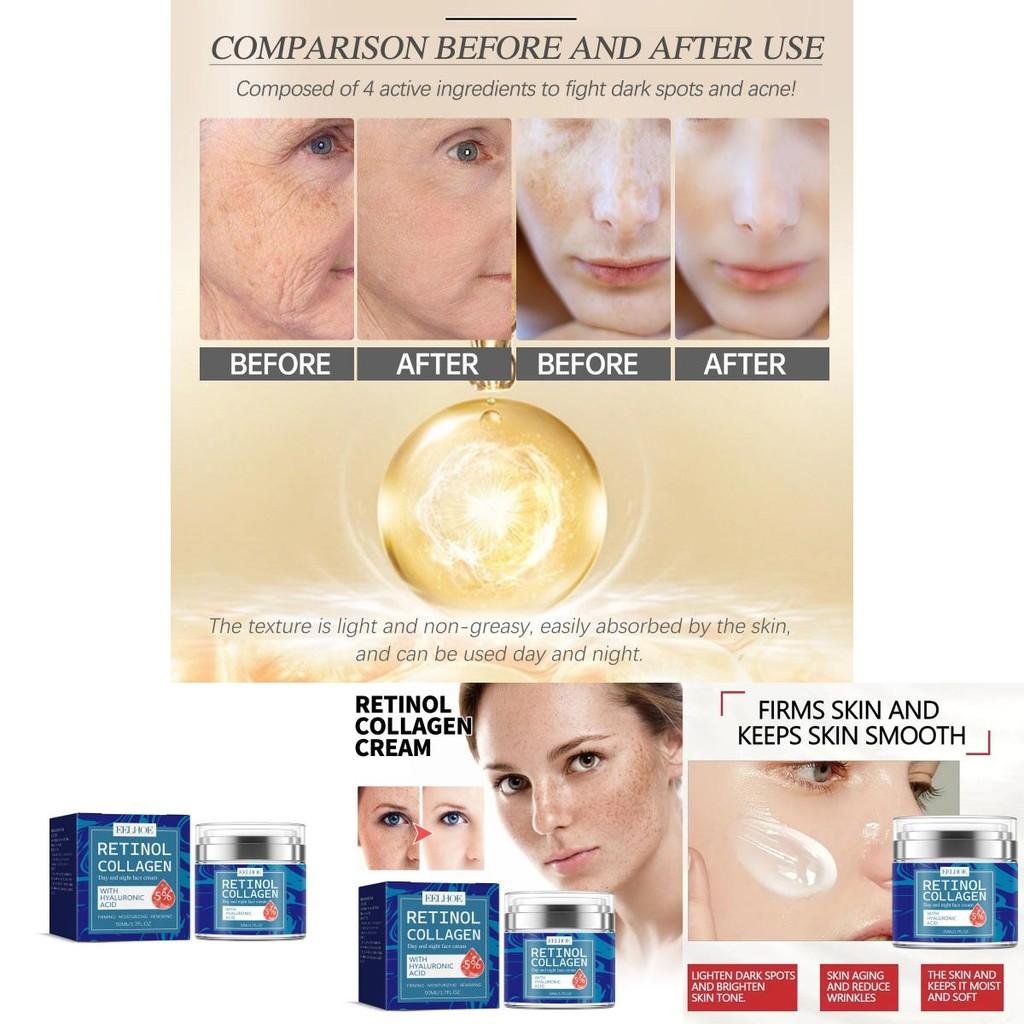 Eelhoe Retinol Collagen Cream For Smooth Radiant Skin Reduces Fine Lines And Dark Spots