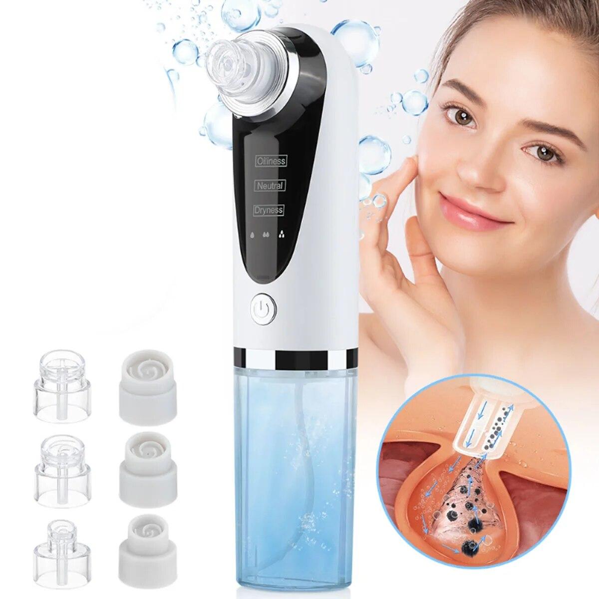 

Portable Small Bubble Electric Beauty Instrument Home Import Pores to Suck Blackheads Clean Oxygen Injector белый