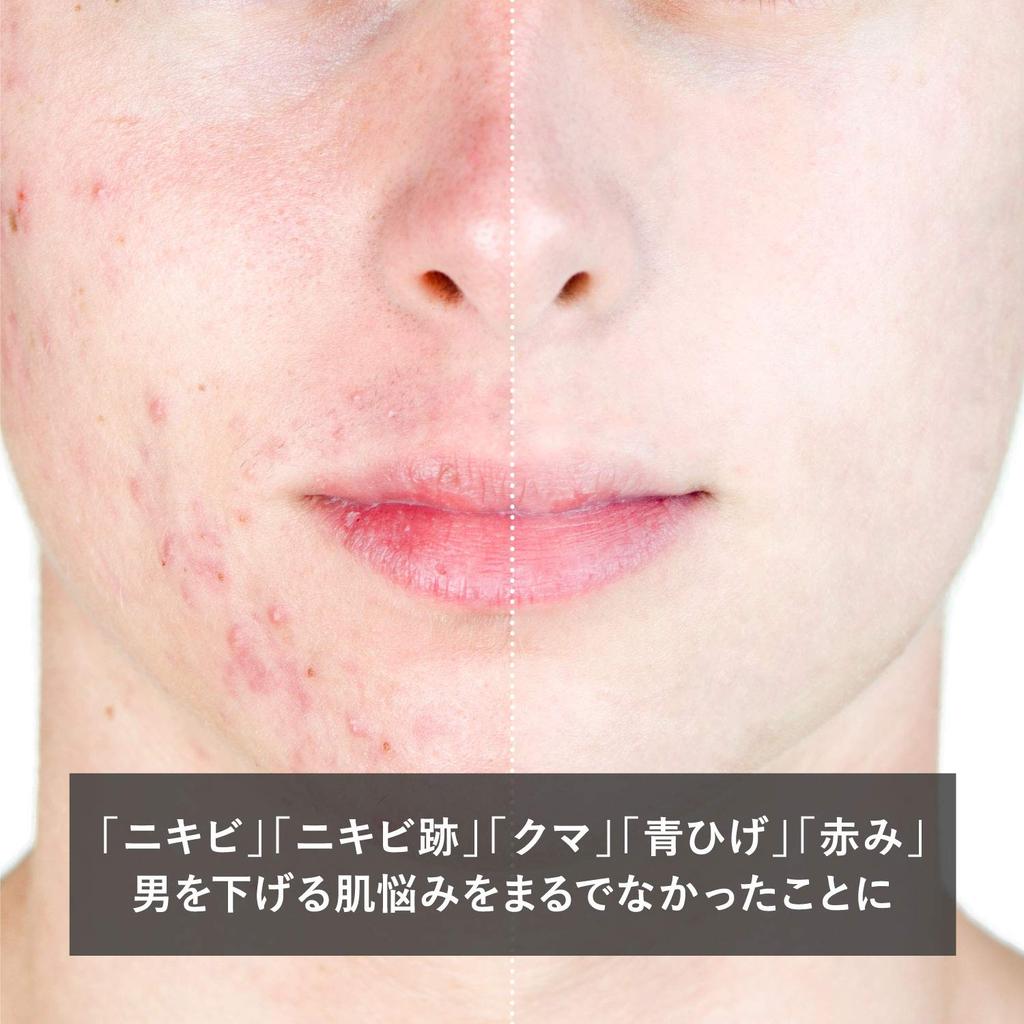 THE FUTHE BB Cream 30g for Skin Trouble Coverage Dark with Warranty Men's (Blue Beard, Acne, Spots)