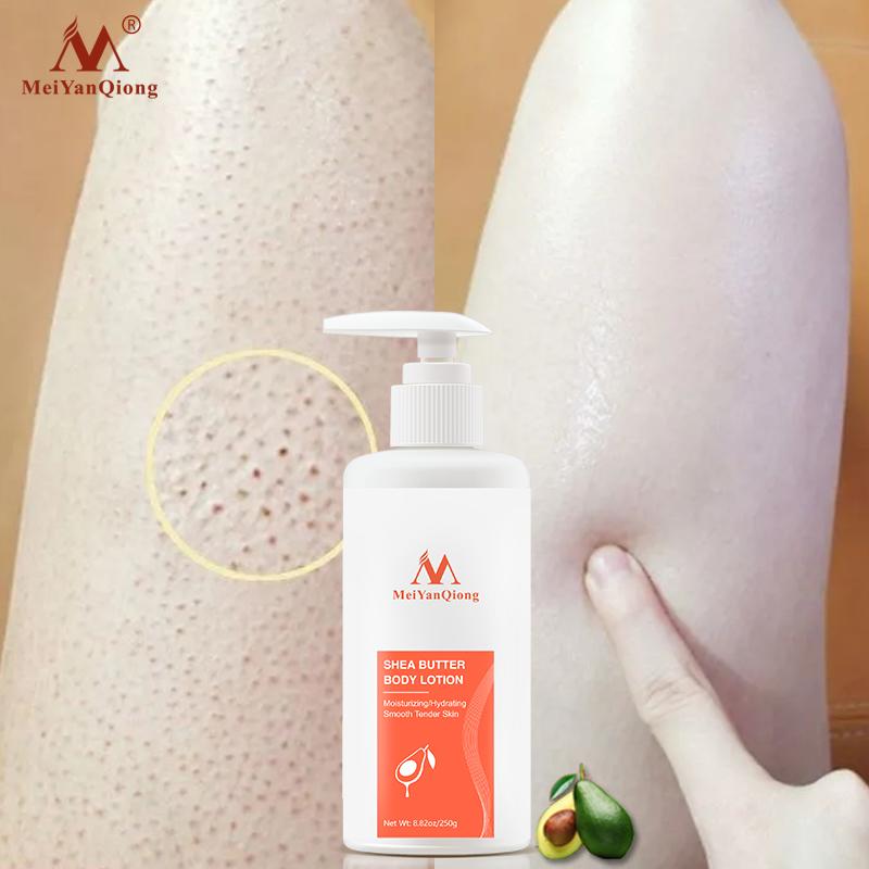 Super Shea Butter Moist Body Lotion Body Creams Moisturizing Skin Care Improve the Skin Dry and Rough Whiteing Ant-Aging Cream