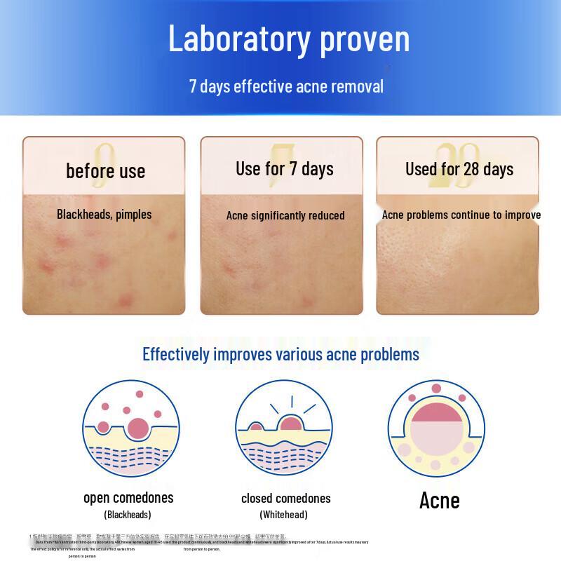 Safeguard White Tea Acne-Fighting Bar Soap